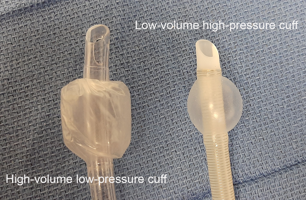 endotracheal tube size right