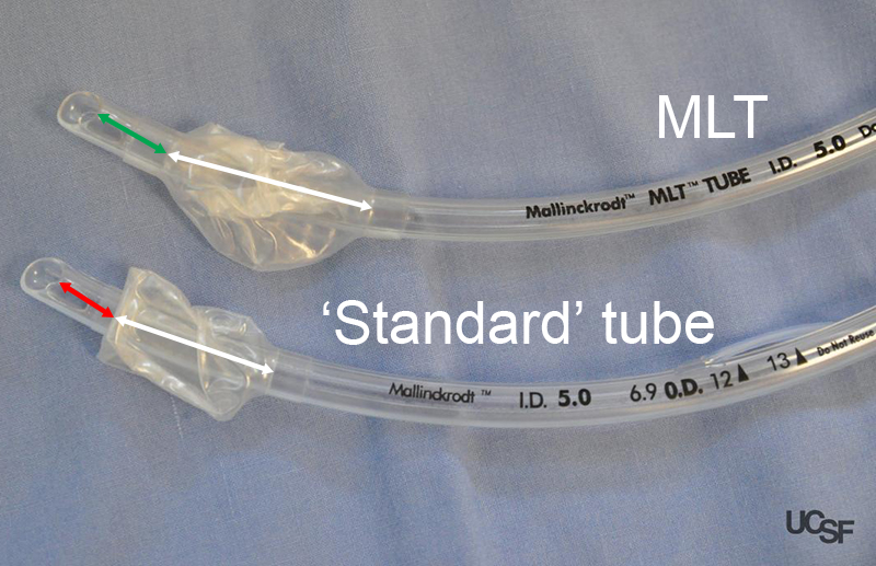 Microlaryngoscopy tube (MLT®) Anesthesia Airway Management (AAM)