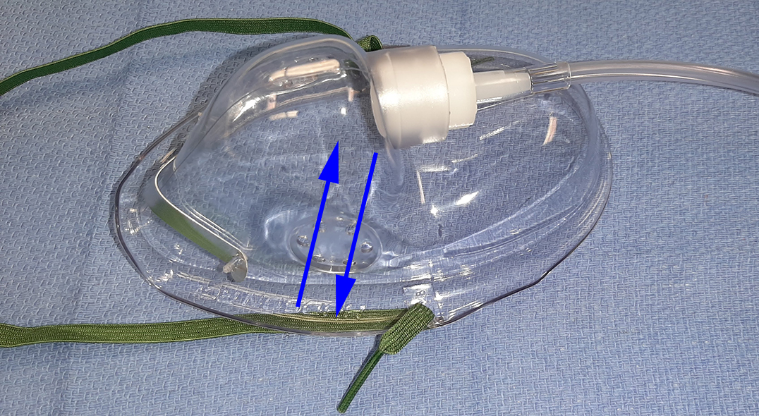 delivery devices | Anesthesia Airway Management (AAM)