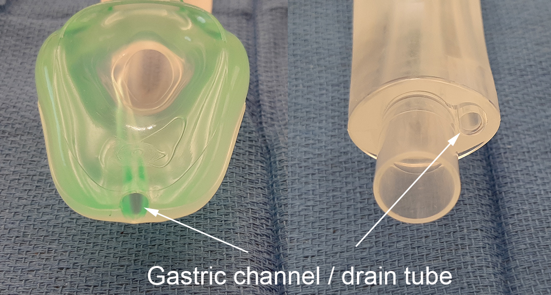 Supraglottic Airway Sizes